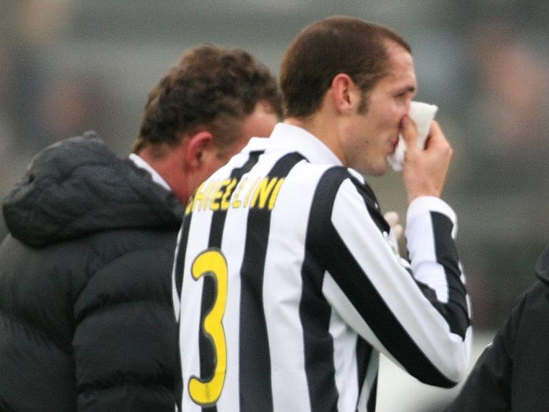 Juve, Chiellini: 'Ora troviamo continuità' VIDEO