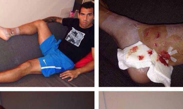 FOTO Tevez attacca Immobile: 'Mi ha quasi rotto e ha preso solo un giallo...'