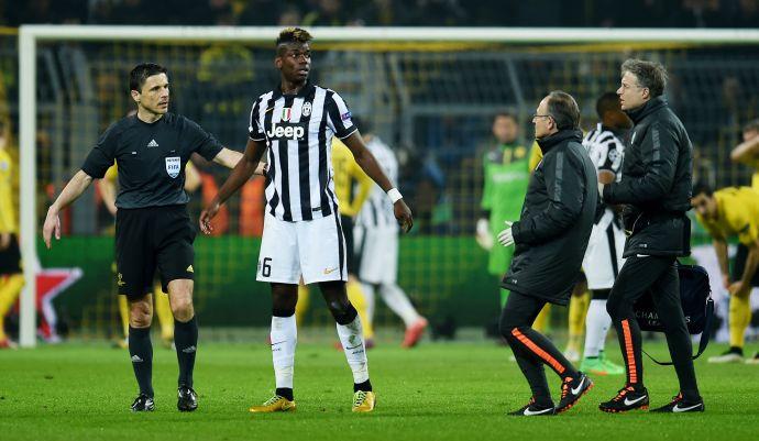 Juve, UFFICIALE: Pogba fuori due mesi