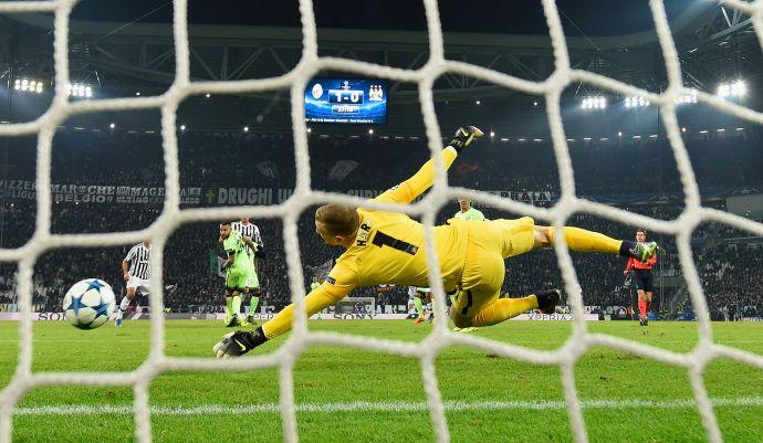 Manchester City: nuovo prestito per Hart