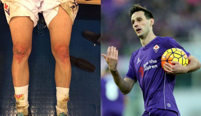 Kalinic come Torres, il Chelsea ci prova