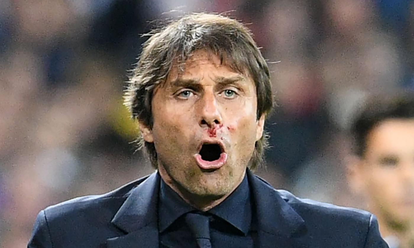 Belgio-Italia: Conte, che infortunio! Esulta troppo e si ferisce