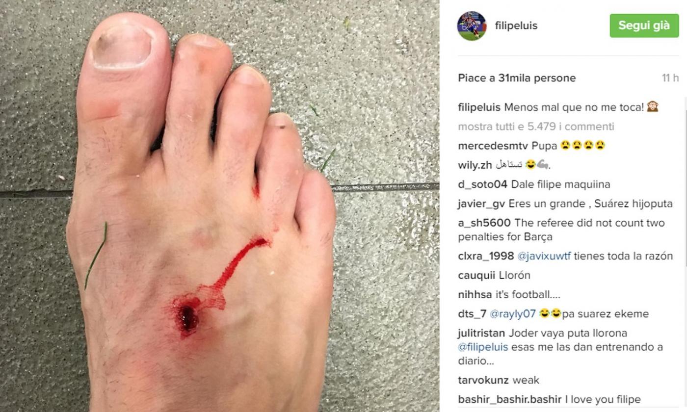 Ferito da Suarez, Filipe Luis posta la foto: 'Meno male che non mi hai preso'. La replica: 'Il calcio è per uomini'