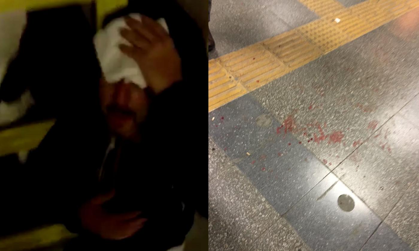 Besiktas-Napoli: tifoso italiano pestato a sangue in metro FOTO e VIDEO