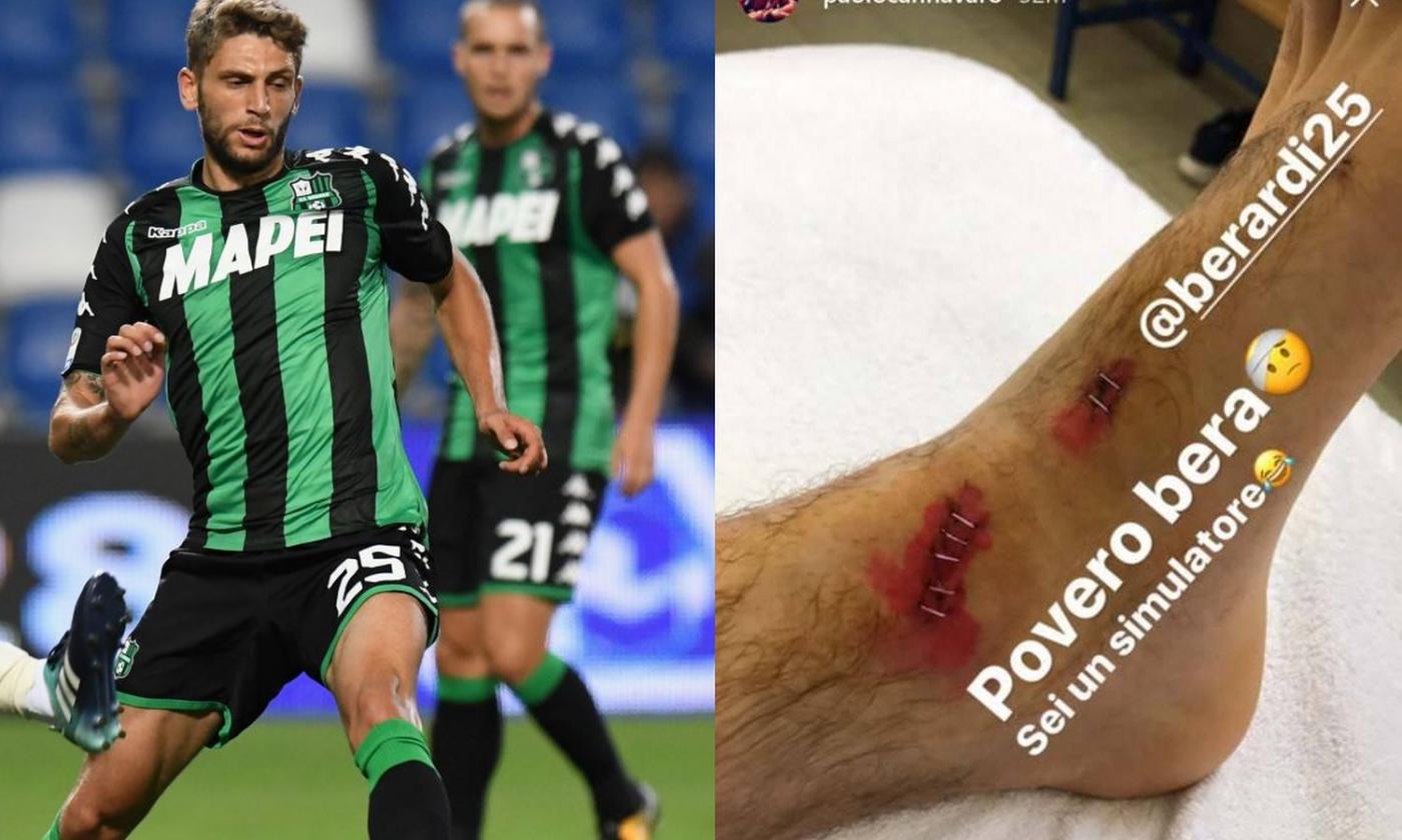 Sassuolo star set to miss Juve clash, posts photo of injury on social media