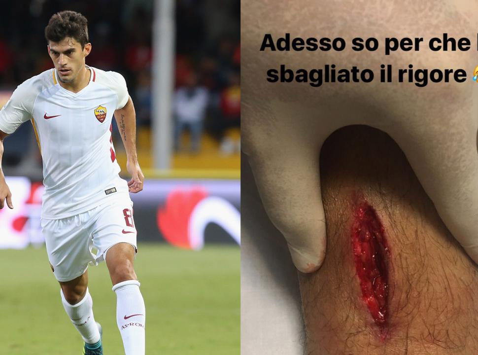 Roma Punti Di Sutura Per Perotti Ecco Perch Ho Fallito Il Rigore Foto Serie A