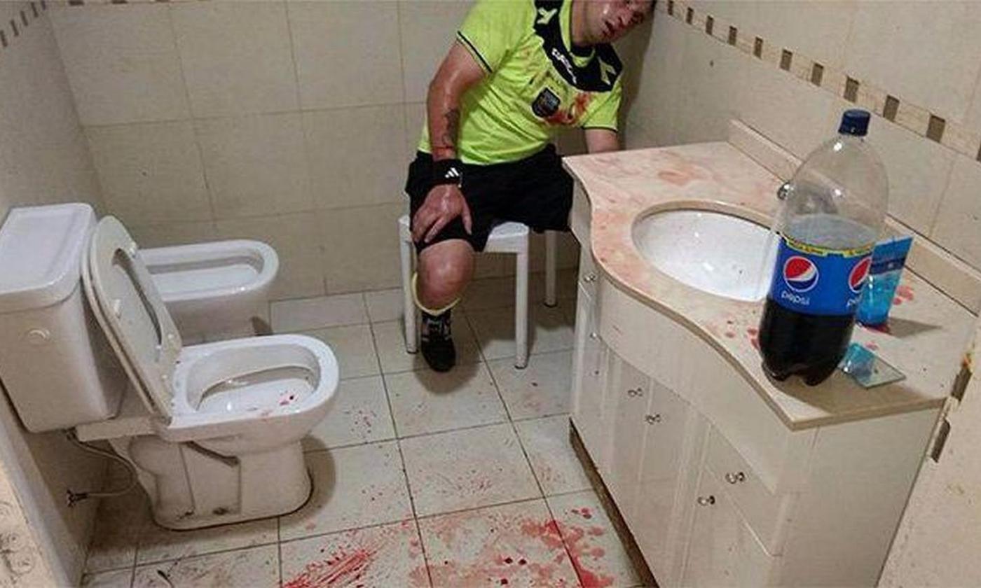 Argentina: arbitro picchiato a sangue dai tifosi, la FOTO fa il giro del mondo 