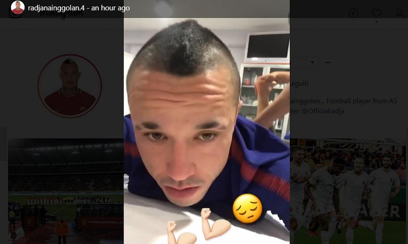 Roma, Nainggolan preoccupato sui social, il derby si allontana FOTO