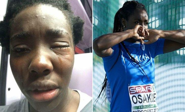 Daisy Osakue, campionessa italiana di origine nigeriana, ferita in un sospetto atto di razzismo: 'Codardi'