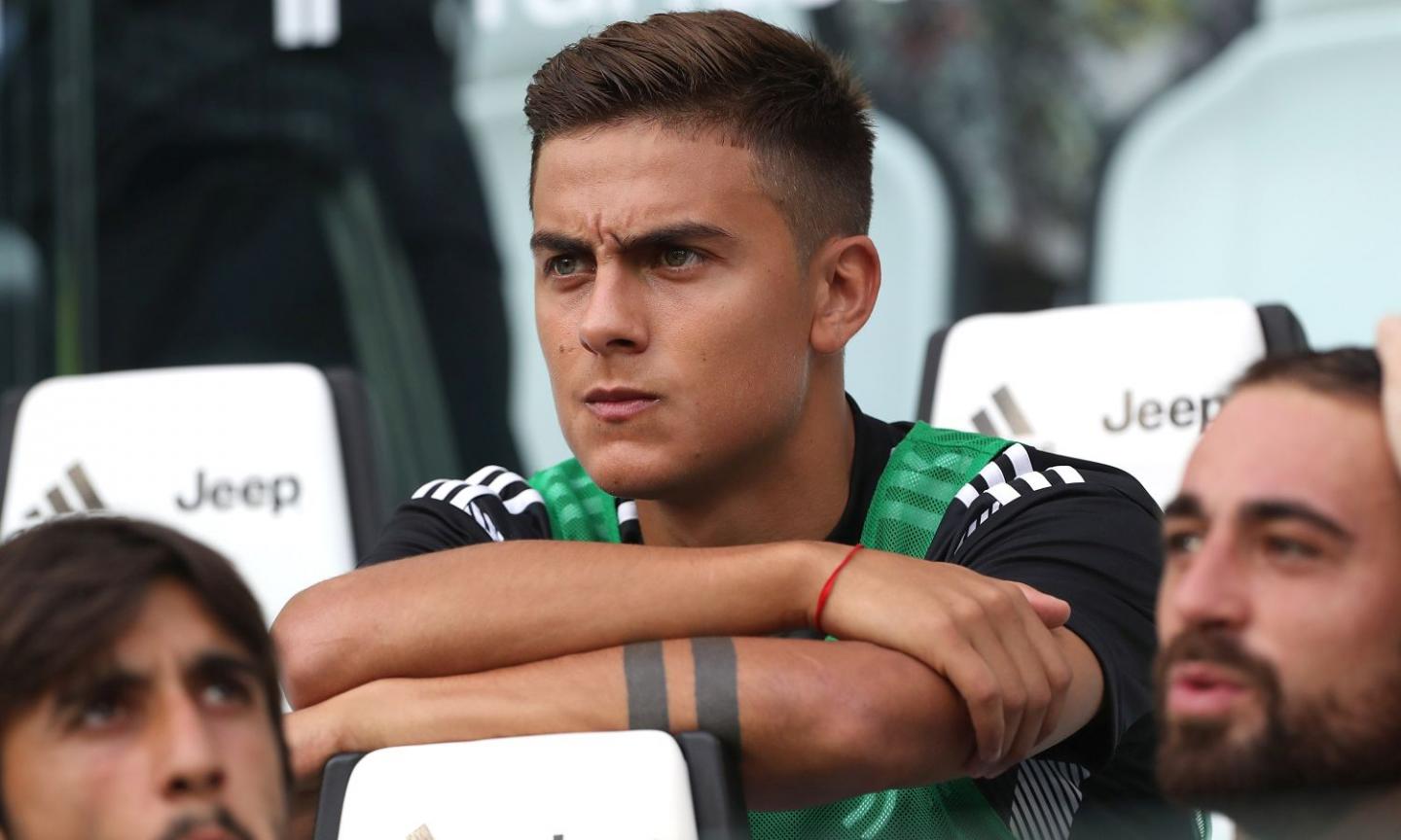 Allegri: Dybala must work hard