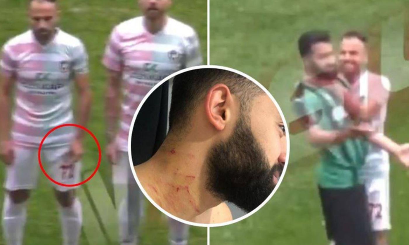 Incredibile in Turchia: un giocatore aggredisce in campo gli avversari a colpi di lametta FOTO e VIDEO