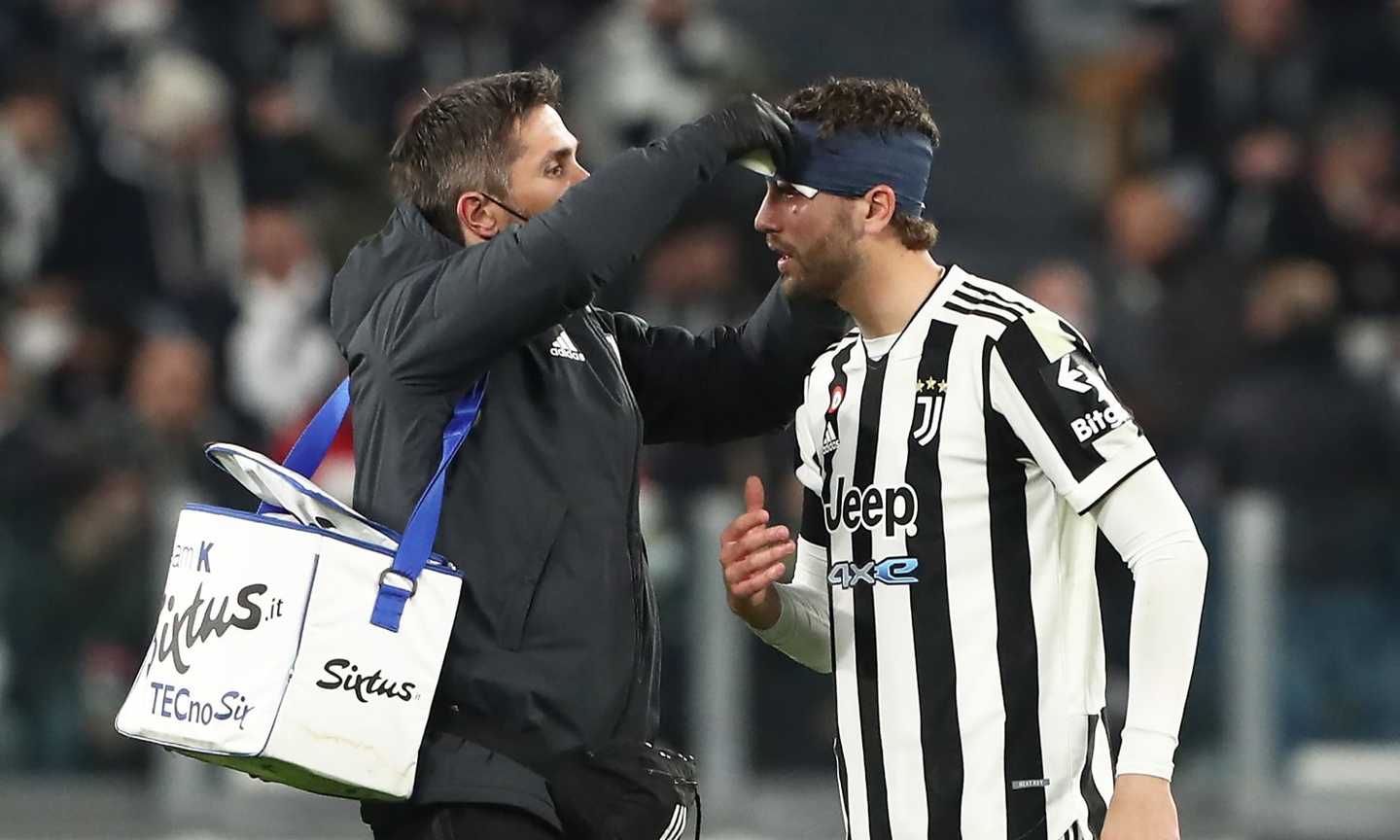 Juve, solo un mese con il centrocampo al completo: ancora emergenza, come cambierà Allegri