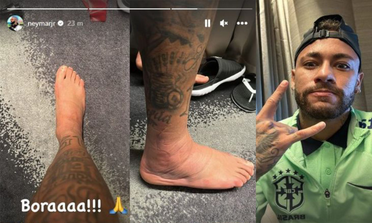 Neymar infortunato: la FOTO della caviglia gonfia è impressionante