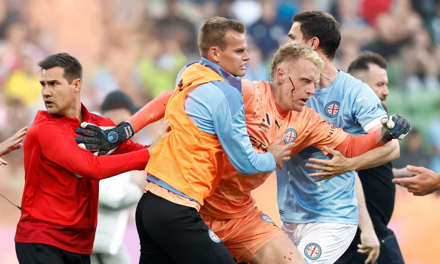 Incredibile in Australia: tifosi invadono nel derby di Melbourne, ferita al volto per un giocatore VIDEO