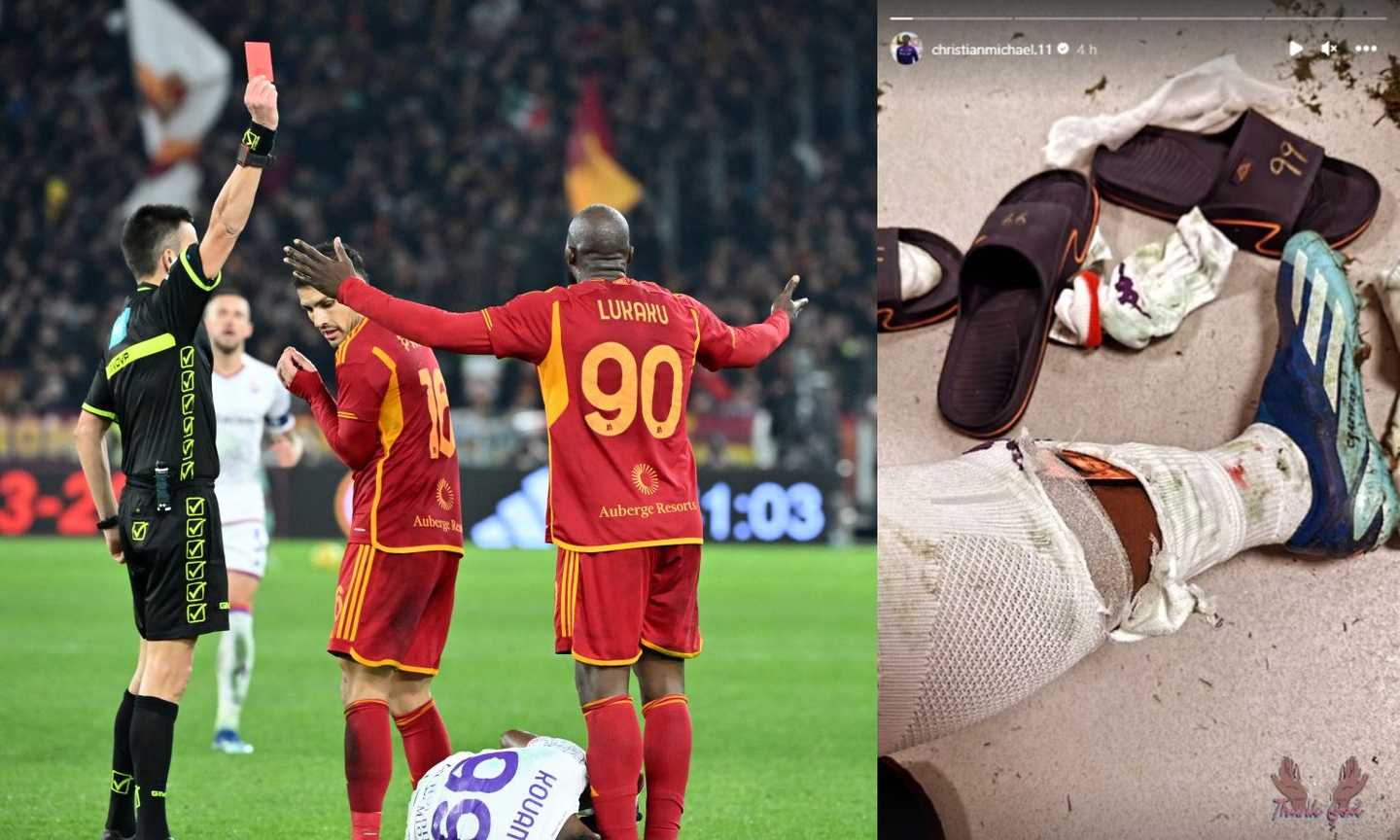 Kouame mostra la gamba ferita da Lukaku: 'Grazie a Dio' FOTO