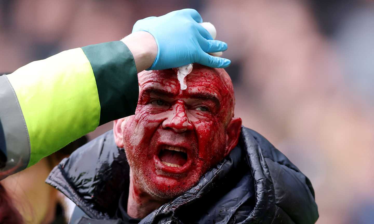 FA Cup, derby West Bromwich-Wolves sospeso: invasione dei tifosi, scontri e paura per le famiglie dei giocatori