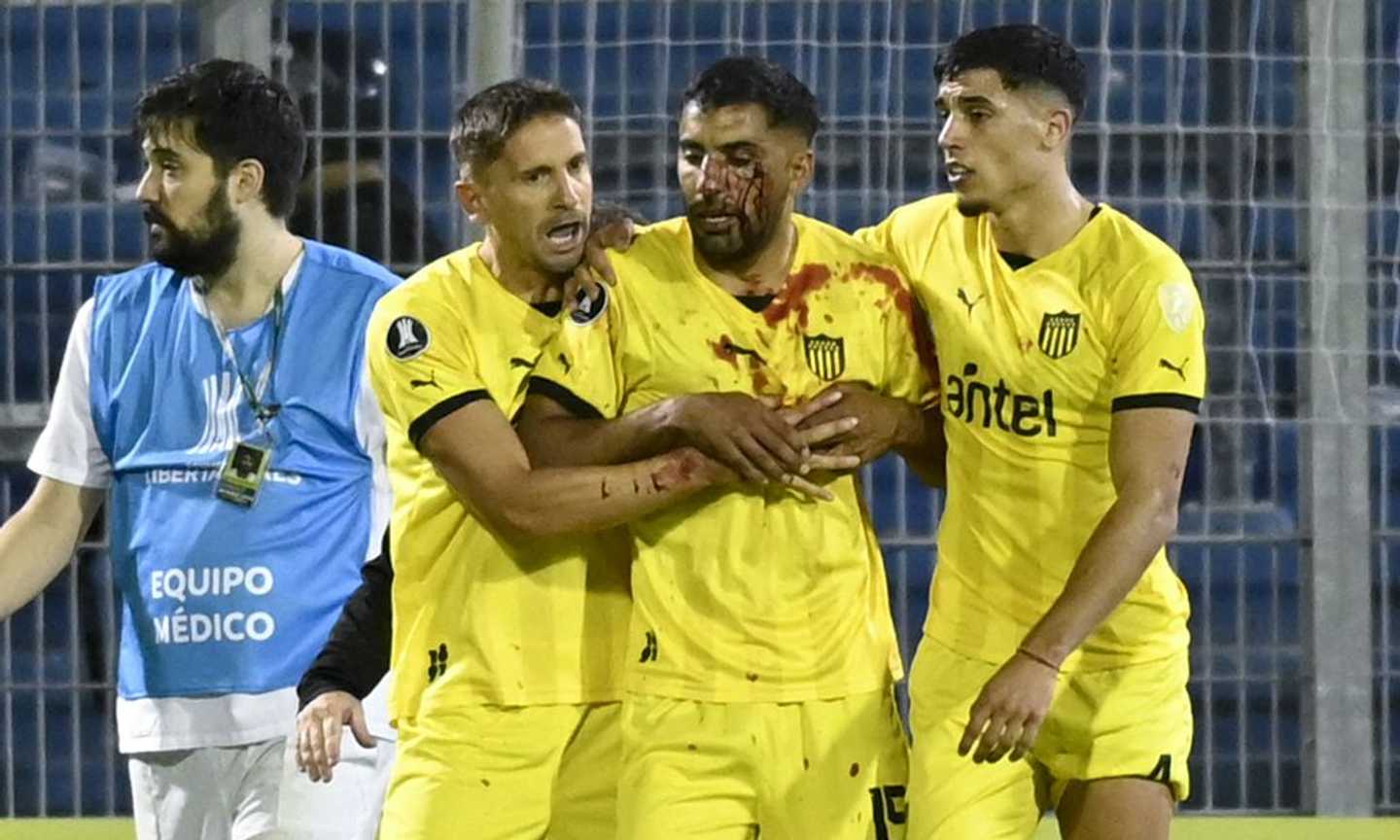 Ex Fiorentina, Maxi Olivera colpito al volto da una pietra in Rosario-Penarol di Copa Libertadores