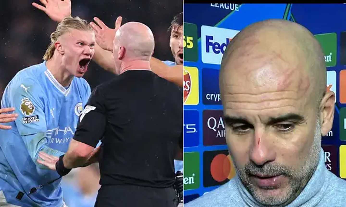 Guardiola con ferite e graffi sul volto: "Volevo farmi male". Cos'è successo