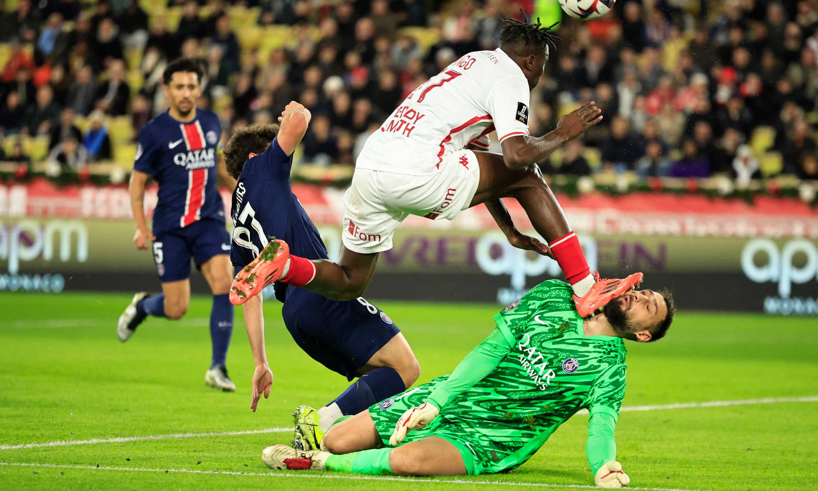 Donnarumma ko: tacchetti in faccia da Singo (solo ammonito) ed è costretto a uscire, punti sul volto sfigurato FOTO